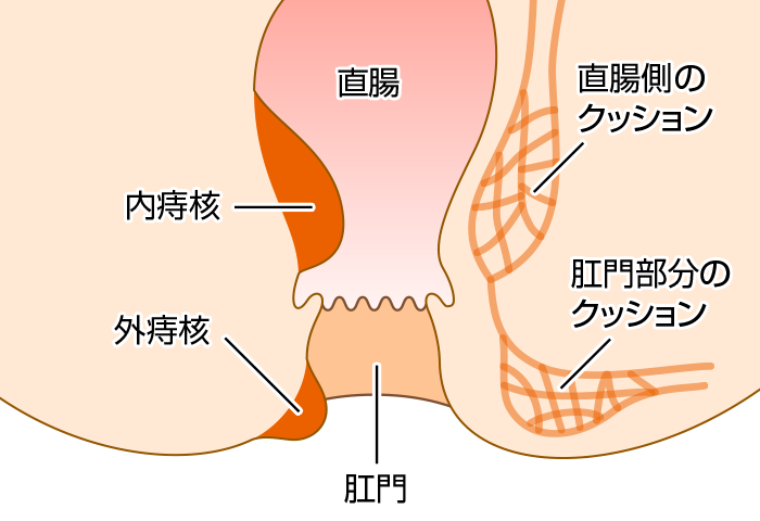 痔 いぼ