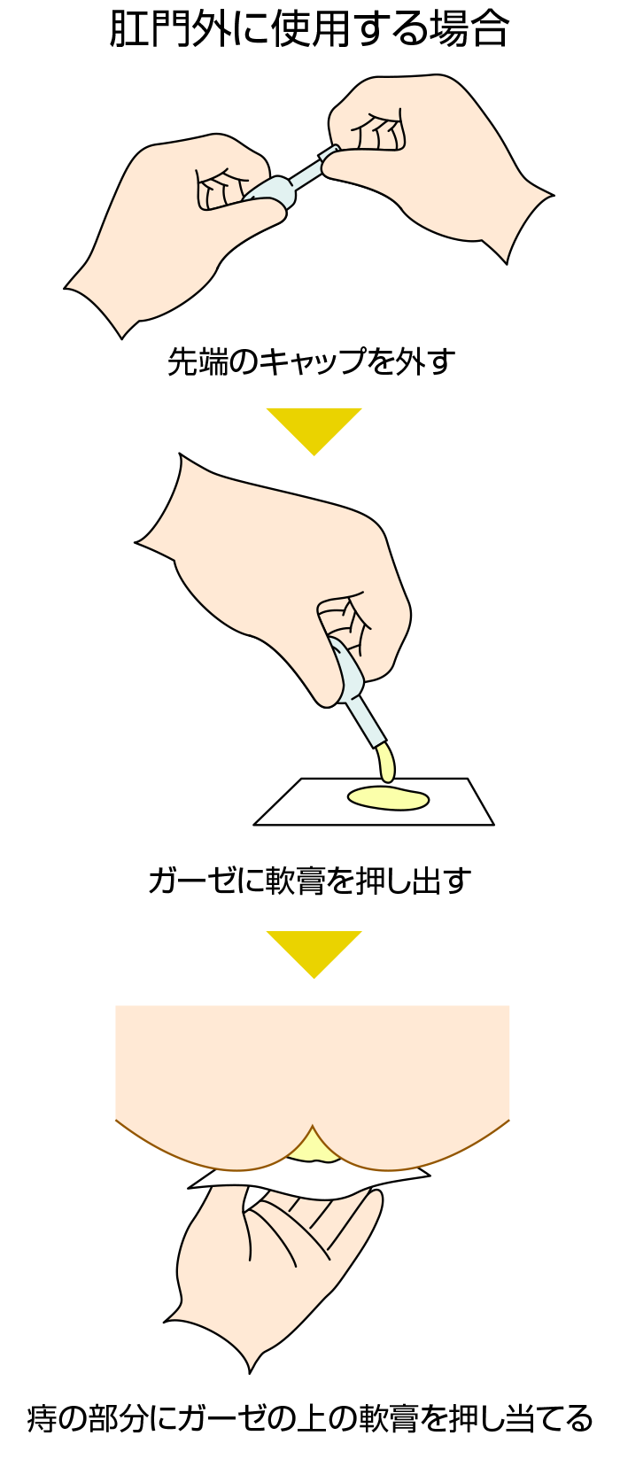 肛門外に使用する軟膏の使い方