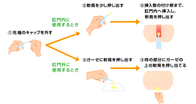 肛門内に 使用するとき、肛門外に 使用するとき 