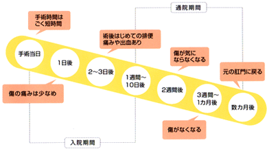 手術から治癒までの流れ