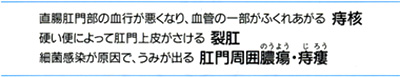 痔ろう・裂肛・肛門周囲膿瘍・痔ろう