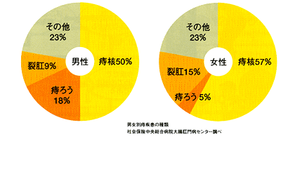 男性 痔核50% 痔ろう18% 裂肛9% その他23%  女性 痔核57% 痔ろう5% 裂肛15% その他23%　男女別痔疾患の種類
社会保険中央総合病院大腸肛門病センター調べ