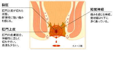 裂肛、肛門上皮、知覚神経