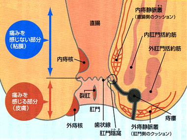 図1：肛門の構造と三大疾患（痔核・裂肛・痔ろう）